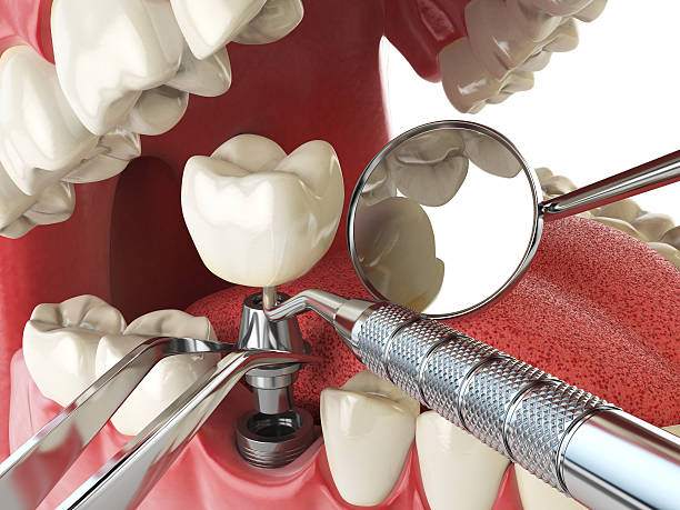 Best Emergency Tooth Extraction in Green Valley, SD